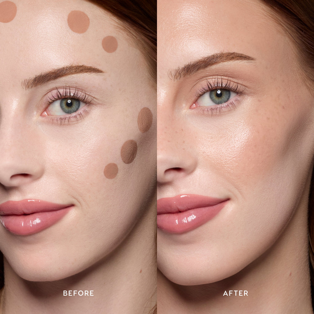 West Beach